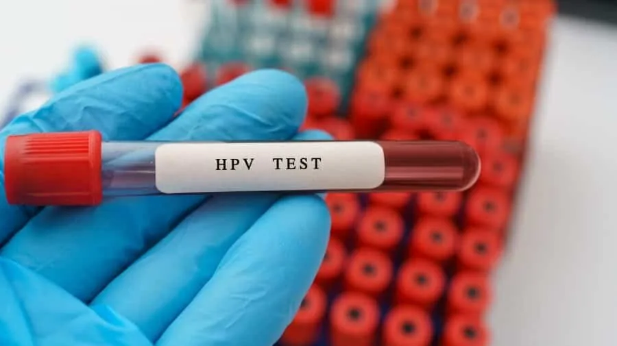 سن اچپیوی به ۱۵ سال رسید | زنده ماندن ویروس زیر ناخن تا ۱۴ روز | اگر آزمایش HPV مثبت شد چه کنیم؟