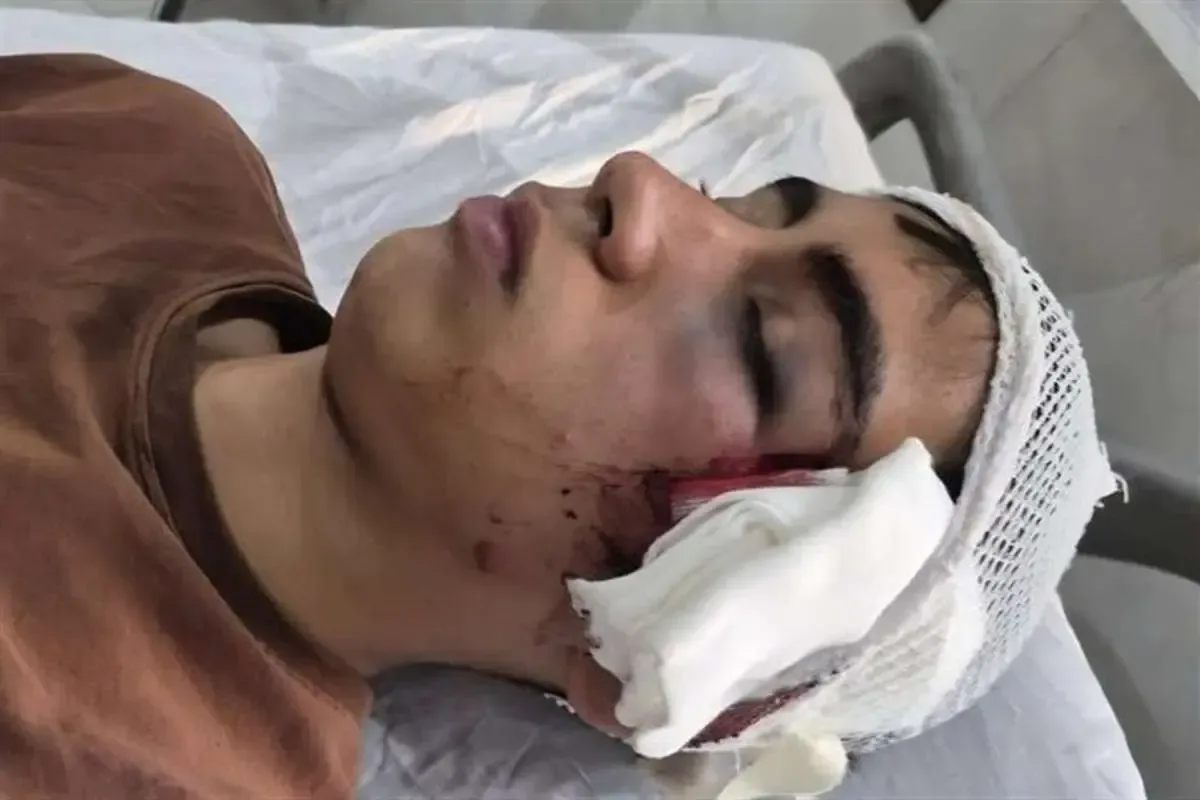 آخرین جزئیات از پرونده تنبیه بدنی دانشآموز در بم