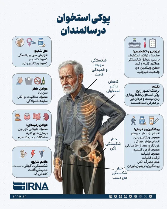 پوکی استخوان؛ بیماری خاموشی که با کم‌تحرکی و آپارتمان‌نشینی جان می‌گیرد