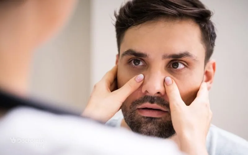 واقعا کمبود آهن را میتوان از روی چهره تشخیص داد؟ نشانههایی که باید جدی بگیرید