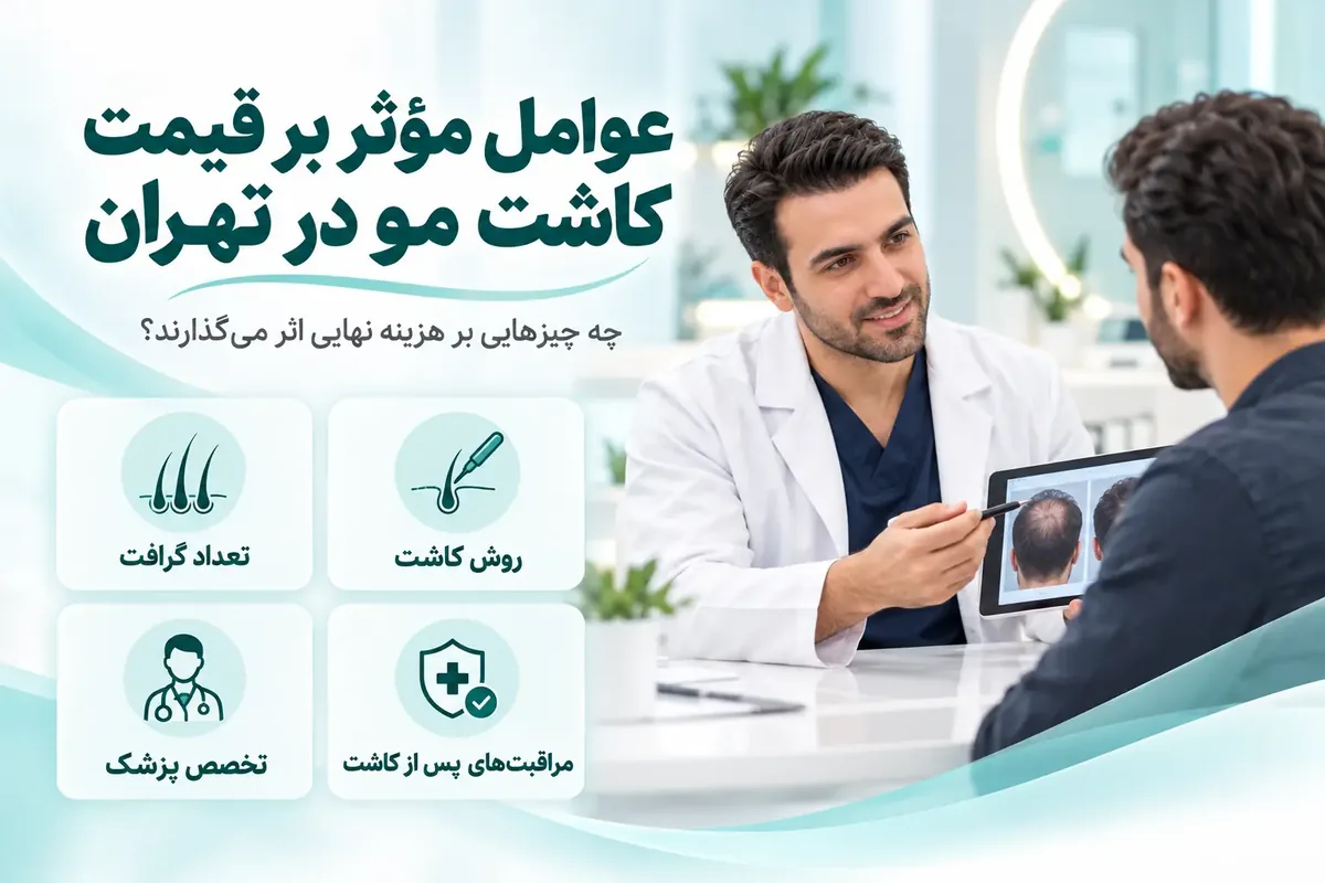 عوامل مؤثر بر قیمت کاشت مو در تهران
