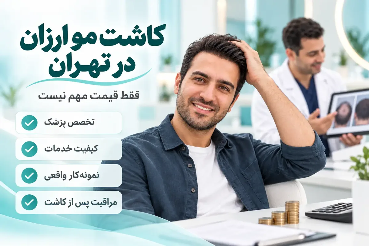 کاشت مو ارزان در تهران