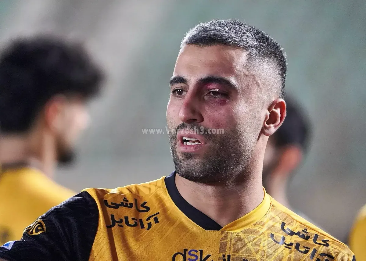 چشم کبود یادگار کاوه از شمسآذر!