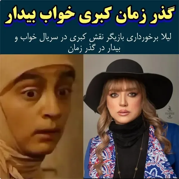 تغییر چهره کبری سریال «خواب و بیدار» + عکس