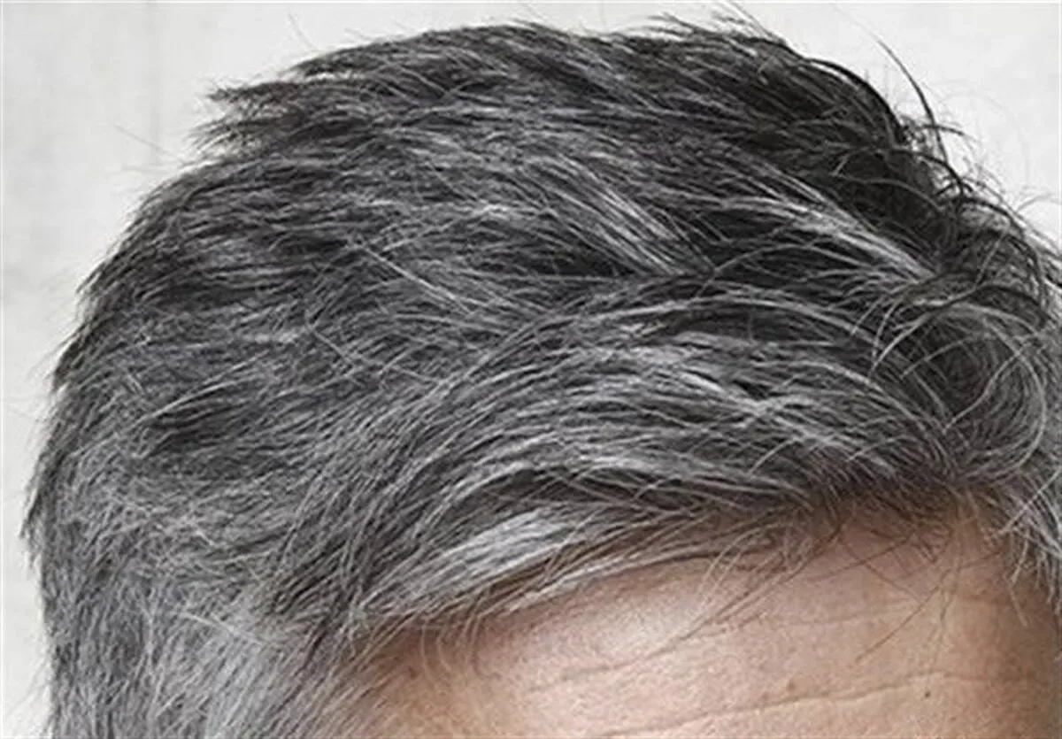 ۸ رازی که موها درباره سلامتی بدن شما فاش میکنند