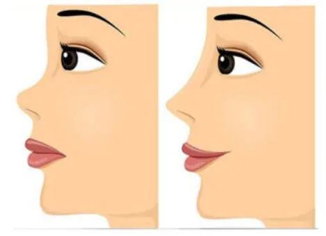 جراح بینی عروسکی در شیراز، معرفی لیست منتخب + ویژگیها و نمونه کارها
