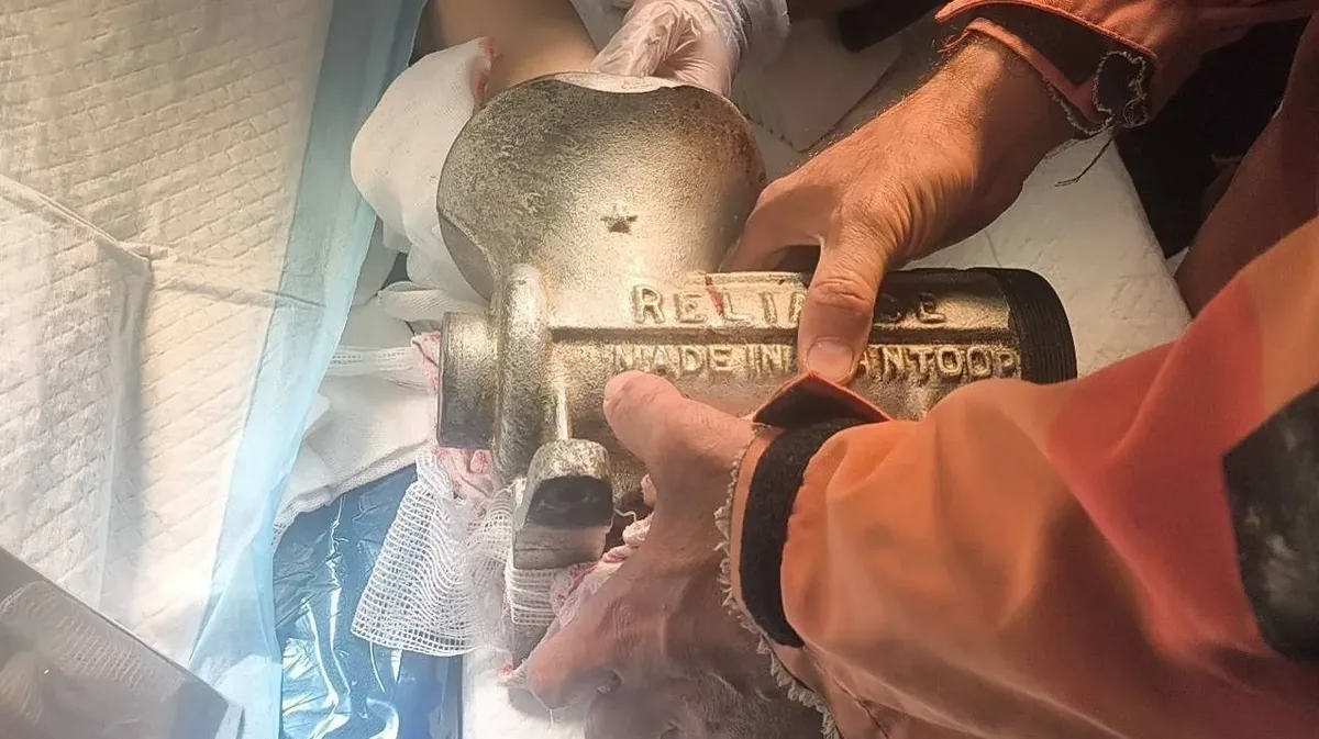 دست زن ۴۸ ساله در چرخگوشت صنعتی گیر کرد