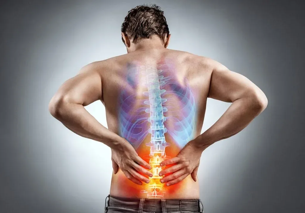 قبل از جراحی دیسک کمر، این نکته مهم را بدانید / MRI بهتنهایی حکم جراحی نمیدهد