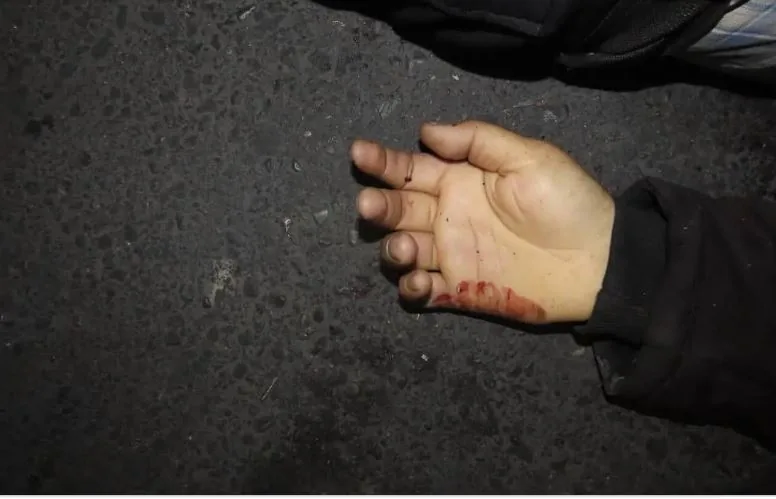 قتل پسر جوان مقابل چشمان پدر در محله فلاح تهران
