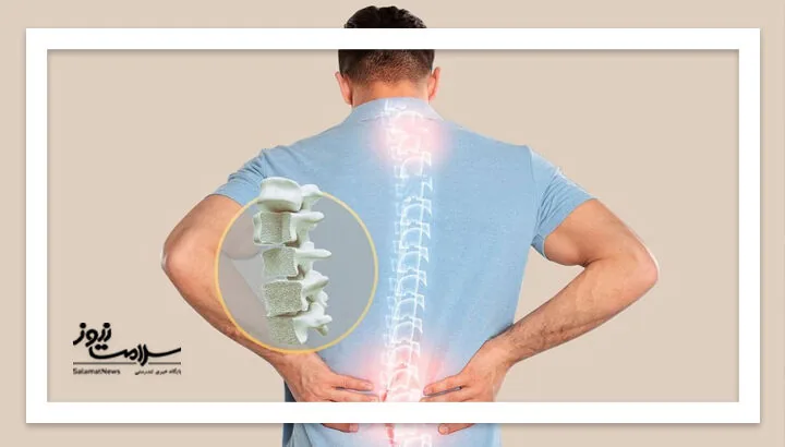 چگونه از پوکی استخوان پیشگیری کنیم؟
