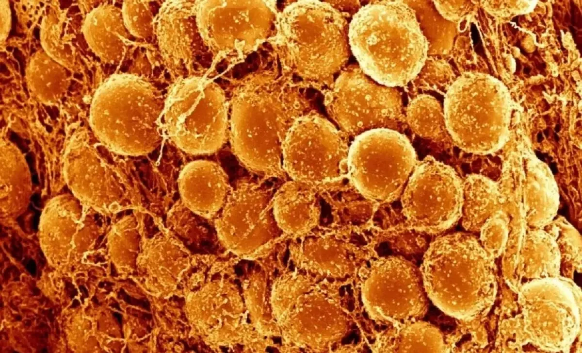 یافته جدید پژوهشگران؛ چربی قهوهای در بدن میتواند برای سلامت قلب و روان مفید باشد