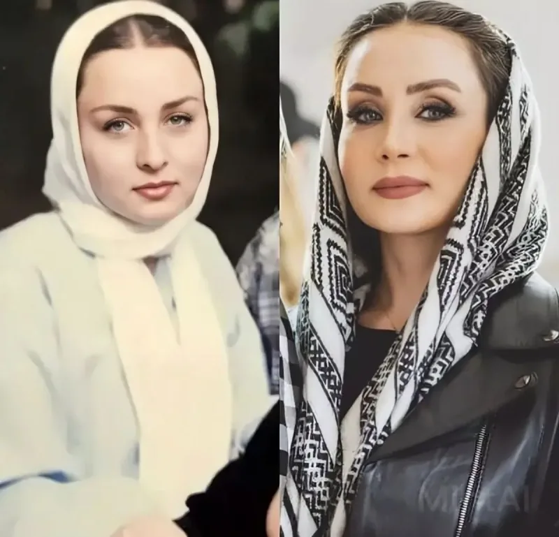 عمل زیبایی حدیث فولادوند
