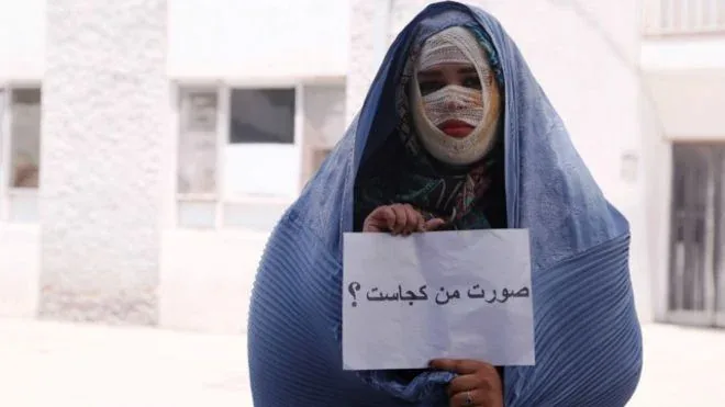 داستان تکان دهنده ازدواج دختر جوان با مردی که به صورتش اسید پاشید+ عکس عروس خانم