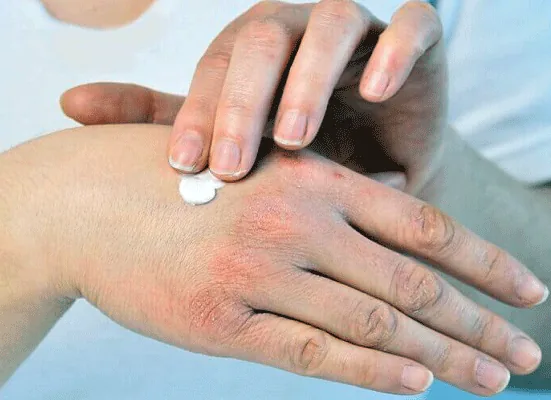 با خشکی پوست در پاییز چه کنیم؟؛ ۶ راهکار خانگی برای نرمی و لطافت پوست