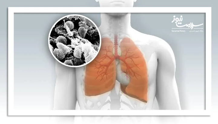 طاعون در روسیه؛ خبری که هنوز هیچ مرجع رسمی تاییدش نکرده است