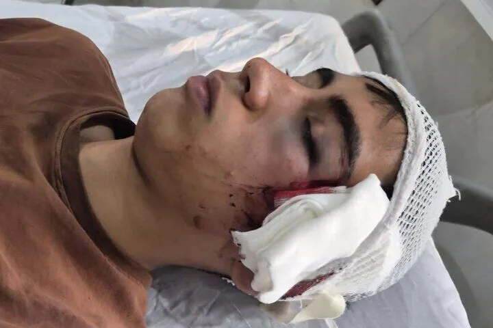 دانشآموز بمی قربانی خشونت معلم شد/ وعده احقاق حق از سوی آموزشوپرورش