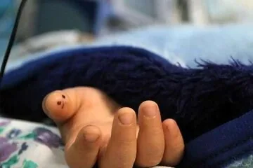 مرگ دختر ۳ ساله بر اثر عقرب گزیدگی در قلعه گنج