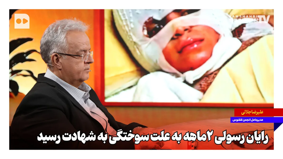 رایان رسولی ۲ماهه به علت سوختگی به شهادت رسید