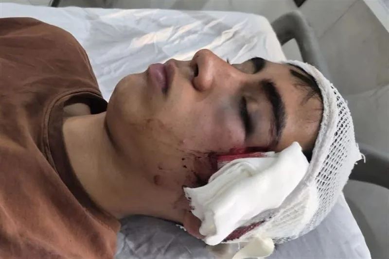 ماجرای تنبیهبدنی دانشآموز بمی توسط معلم