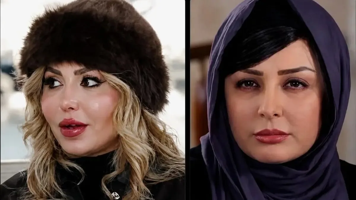 از الهام حمیدی تا نیوشا ضیغمی؛ چرا جراحی زیبایی زنان به قضاوت عمومی گره میخورد؟ | تصاویر