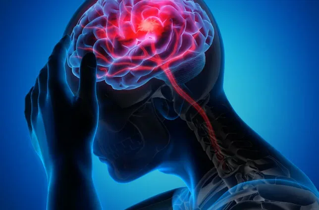 هوش مصنوعی جدید دانشمندان با تحلیل DNA میتواند ریسک سکته مغزی را پیشبینی کند