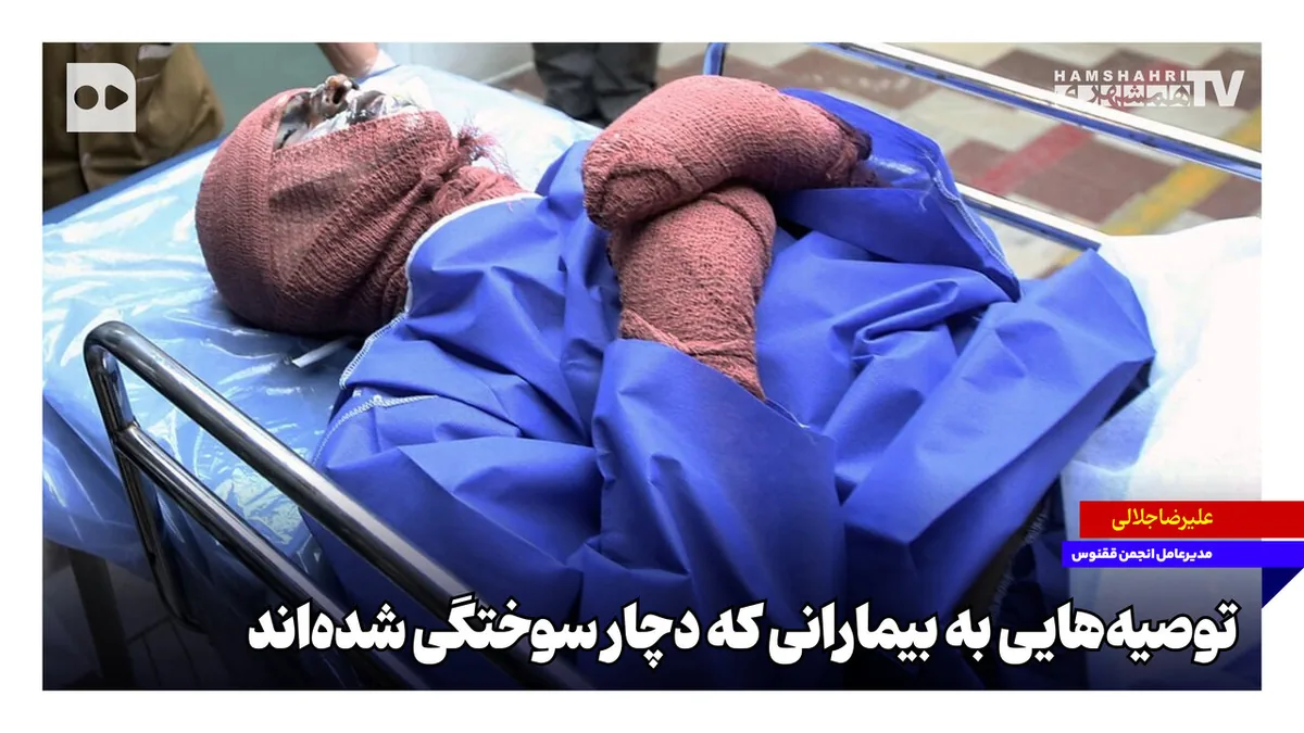 توصیههایی به بیمارانی که دچار سوختگی شدهاند