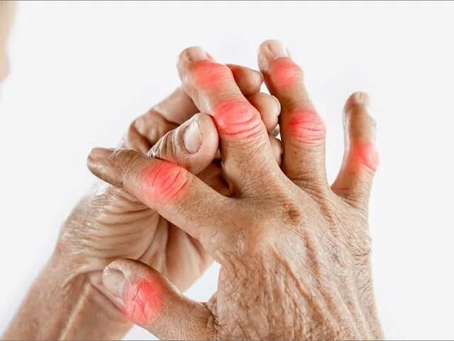 ۱۲ خوراکی که التهاب بدن را بیشتر میکند؛ چه رژیمی برای مفاصل مناسبتر است؟