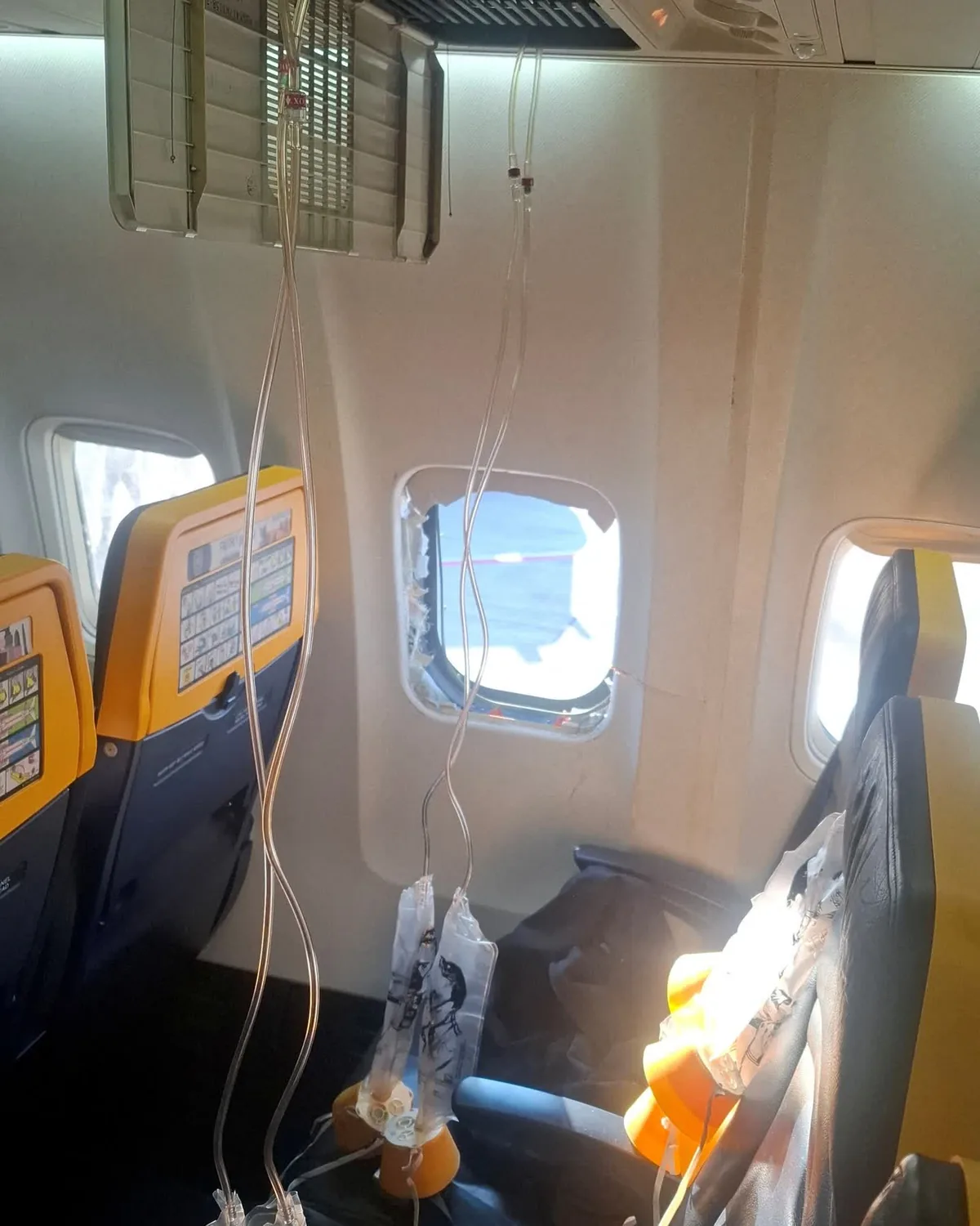 Inside a small aircraft cabin with medical gear: IV tubing hanging from overhead, yellow seat headrests, and a window showing blue sky outside