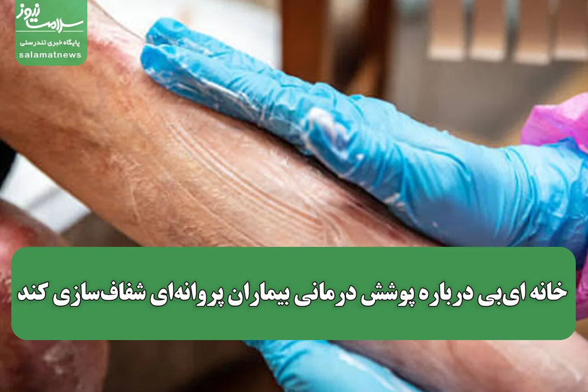 خانه ایبی درباره پوشش درمانی بیماران پروانهای شفافسازی کند