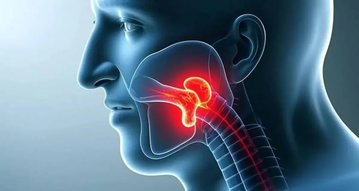 سوزش گلو؛ 8 علت احتمالی و راه های تسکین آن