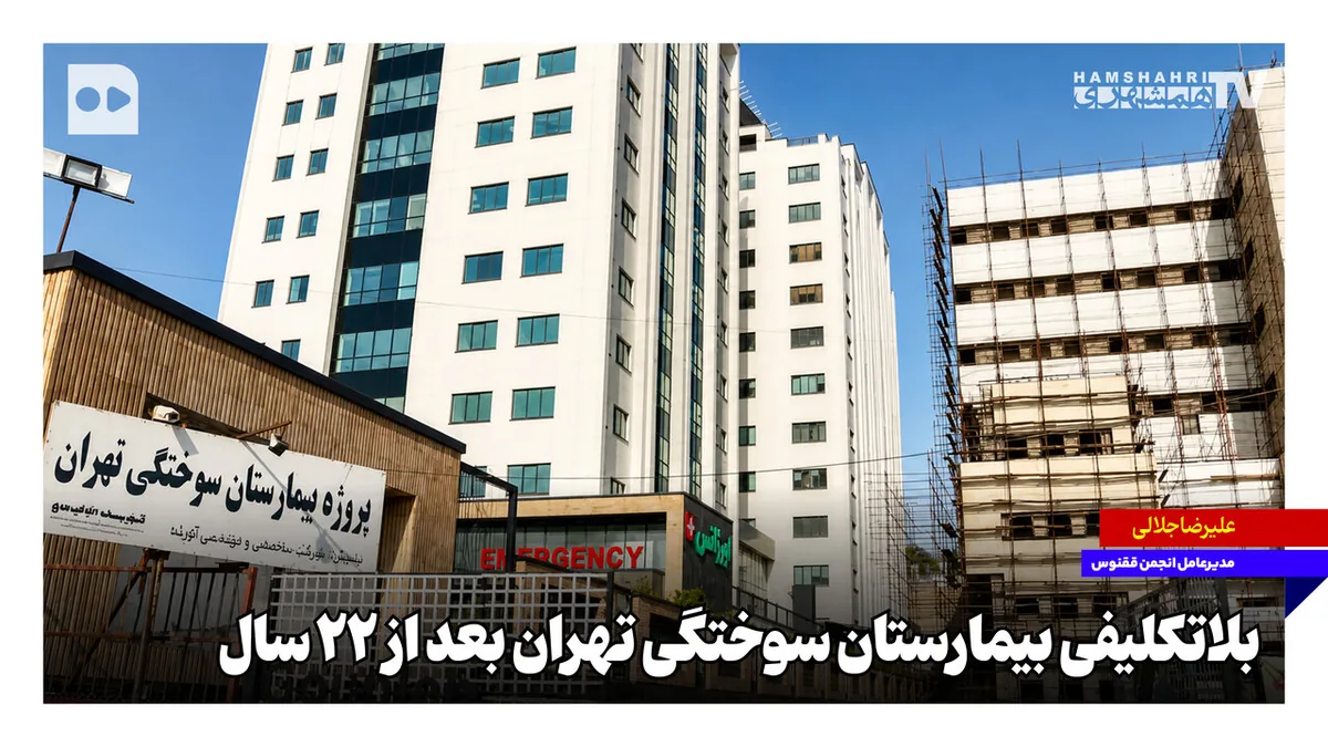 بلاتکلیفی بیمارستان سوختگی تهران بعد از ۲۲ سال