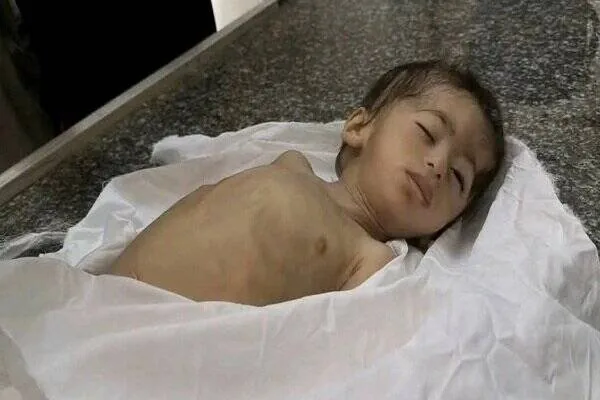 نسل کشی خاموش در غزه؛ کشتاری که دیگر به چشم رسانههای جهان نمیآید