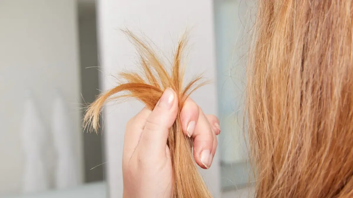 چطوری از شر موخوره خلاص شویم؟